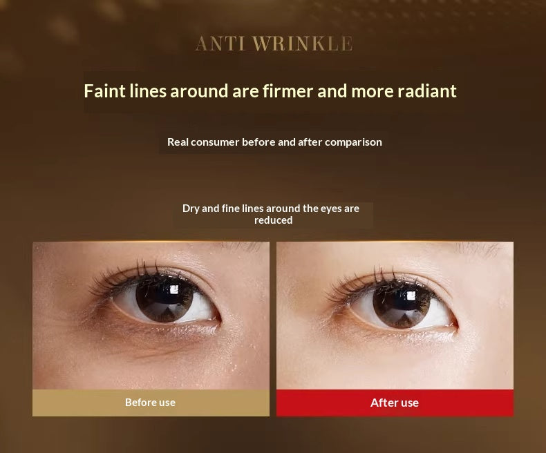 Pro-Xylane Anti-Wrinkle Eye Cream – Fine Line Reduction & Hydration